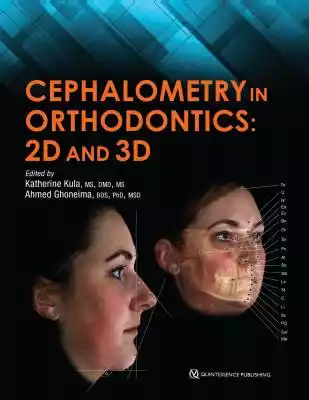 Cephalometrics has been used for decades to diagnose orthodontic problems and evaluate treatment. However,  the shift from 2D to 3D radiography has left some orthodontists unsure about how to use this method effectively. This book defines and depicts all cephalometric landmarks on a skull 
