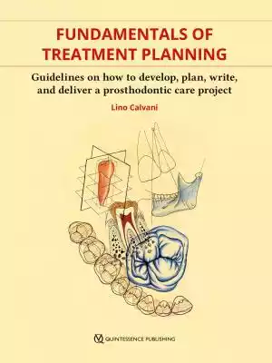 Fundamentals of Treatment Planning Podobne : Treatment Planning in Restorative Dentistry and Implant Prosthodontics - 2443163